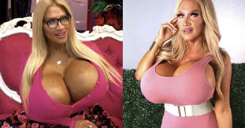 Are breast implants covered by insurance