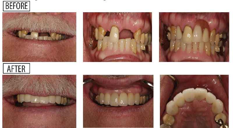 Are partials considered orthodontia