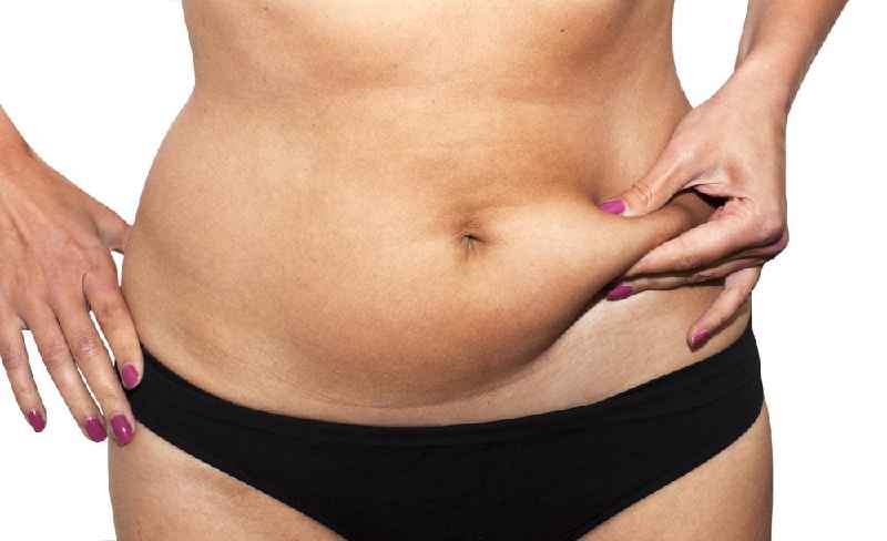 Are there medical reasons for a tummy tuck