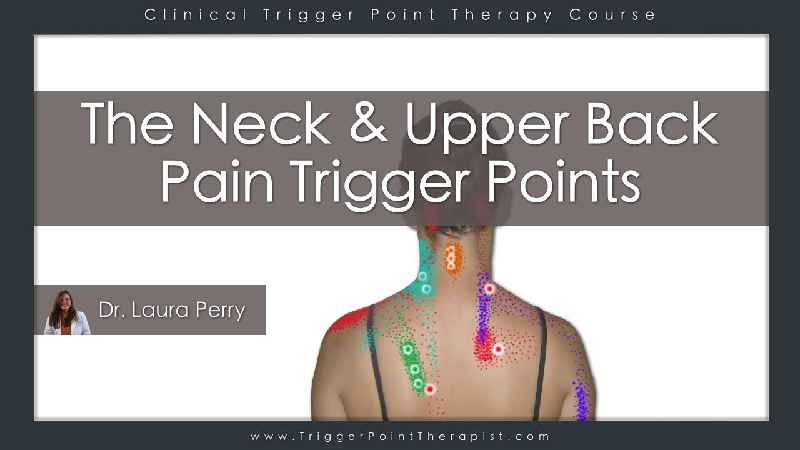 Are trigger points permanent