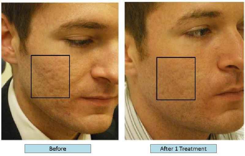 Can a dermatologist perform a facelift