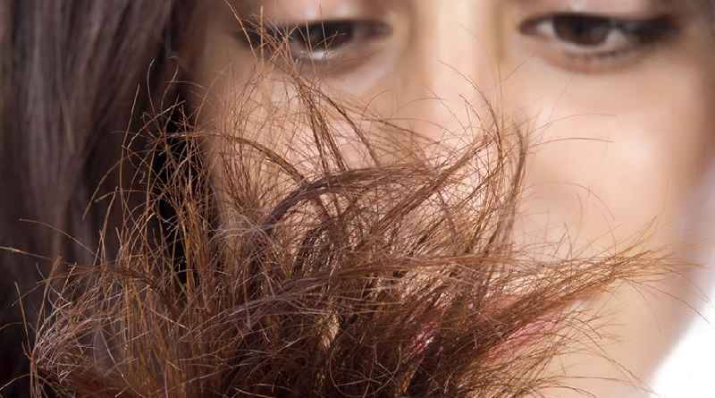 Can a lack of iron cause hair loss