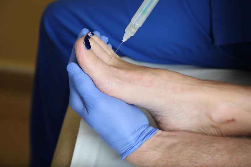 Can a toenail be removed permanently