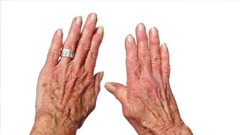 Can arthritic fingers be operated on