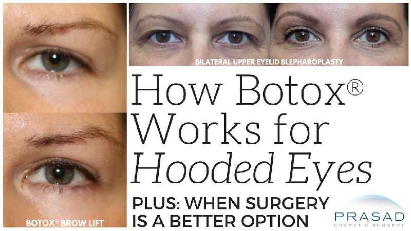 Can Botox help with hooded eyes