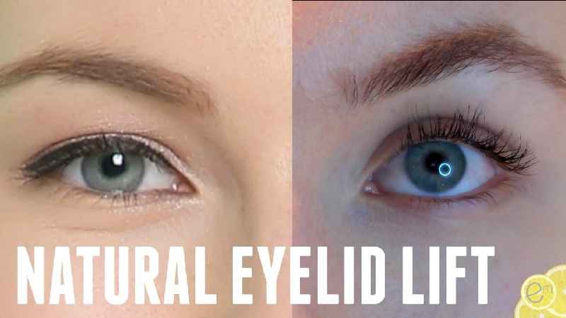 Can Botox lift hooded eyes