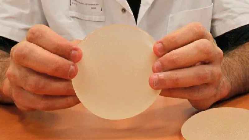 Can breast implants last 30 years