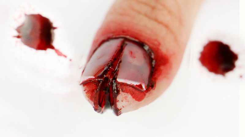 Can carers cut finger nails