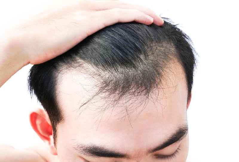Can castor oil regrow receding hairline