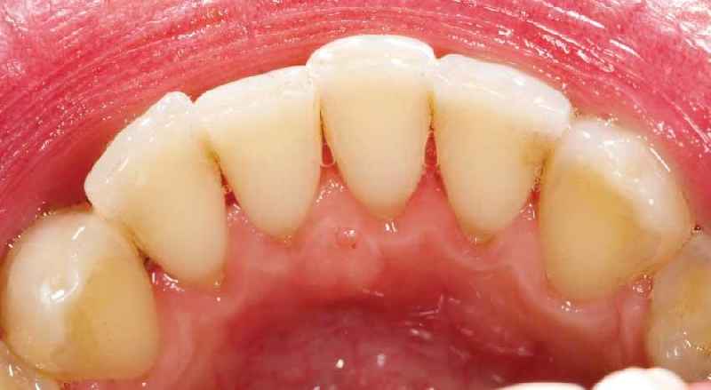 Can dental hygienist diagnose
