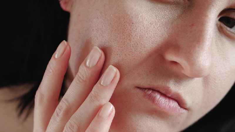 Can Drinking Water clear your skin