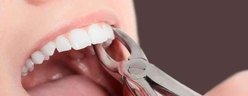 Can estheticians do teeth whitening in Texas