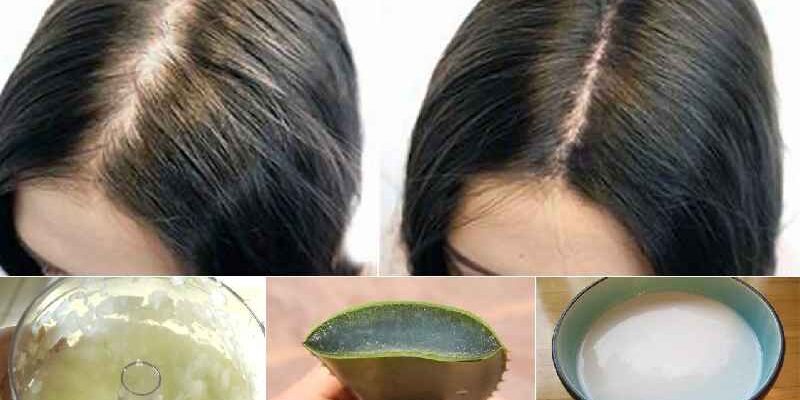 Can female hair loss grow back