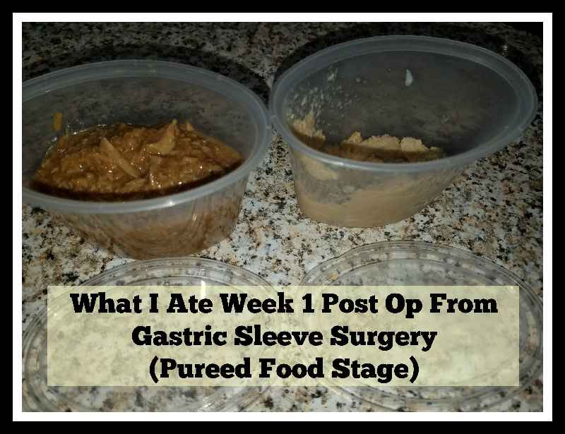 Can I eat pizza after bariatric surgery