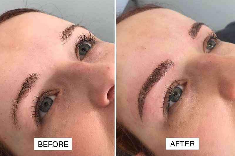 Can I use my CareCredit for Microblading