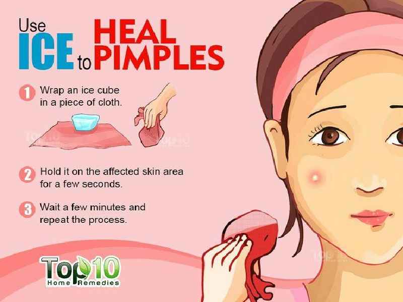 Can Ice remove pimples