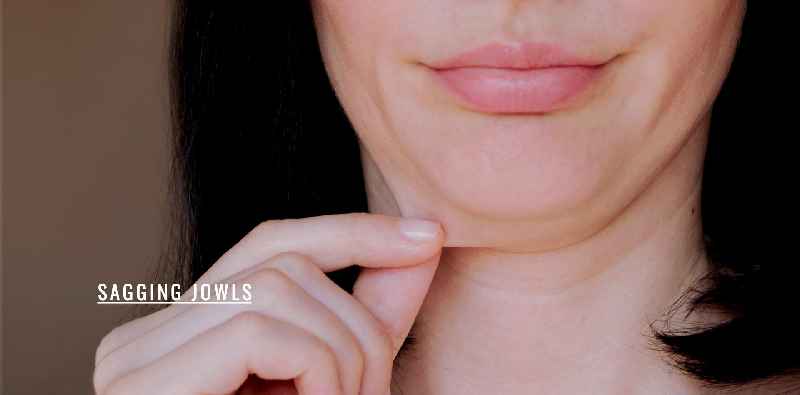Can jowls be lifted without surgery