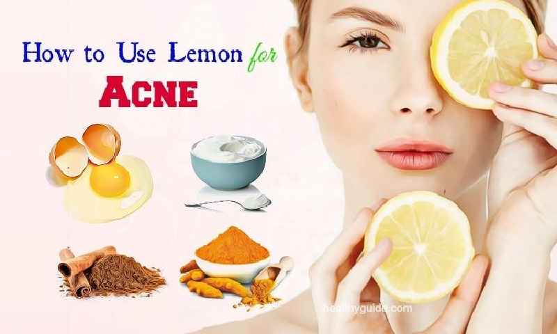 Can Lemon remove pimples