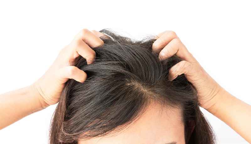Can low estrogen cause your hair to fall out