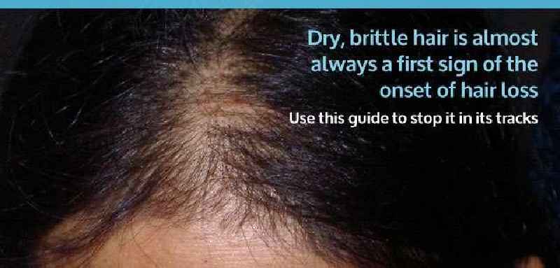 Can low thyroid cause dry brittle hair