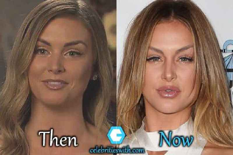 Can Miss Universe have cosmetic surgery