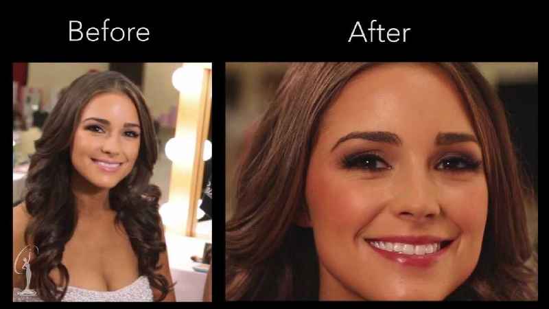 Can Miss Universe have plastic surgery
