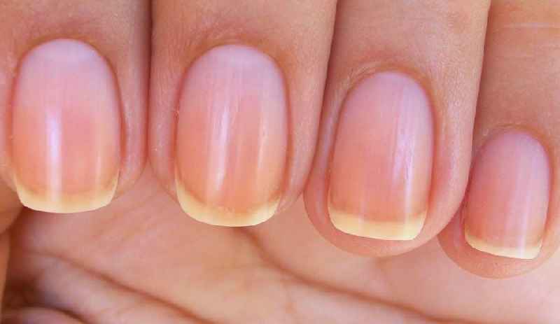 Can nail polish turn your nails white