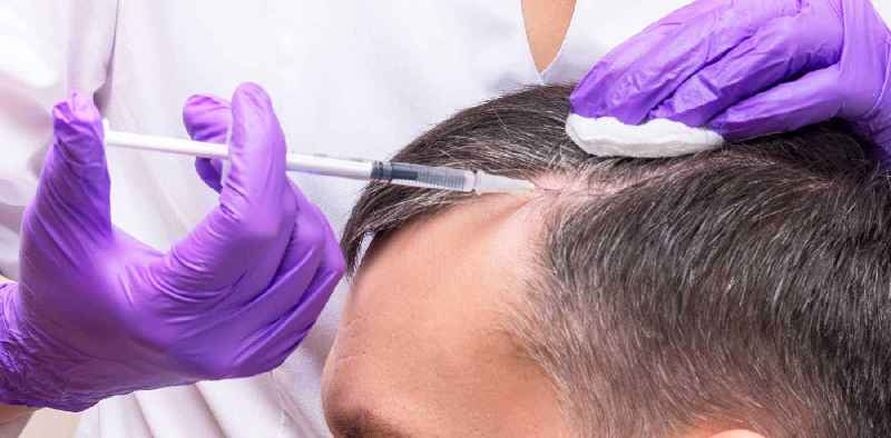 Can perms cause hair loss