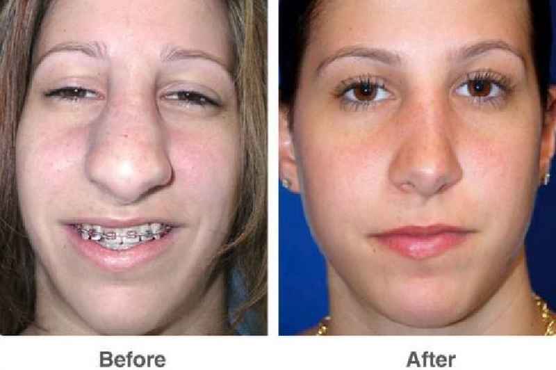 Can plastic surgery Change your face completely