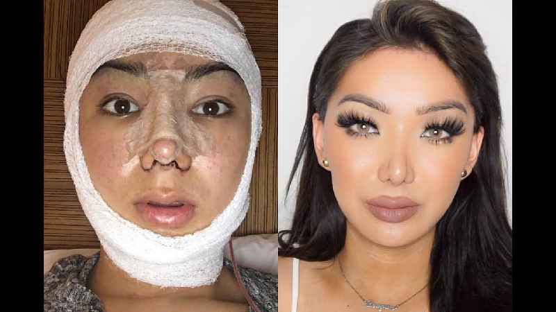 Can plastic surgery Change your face shape