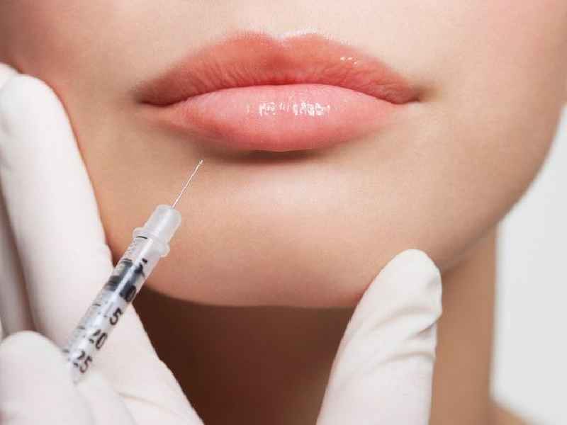 Can PRP replace Botox