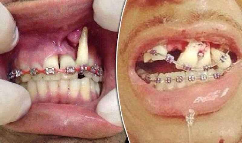Can rotten teeth make you sick