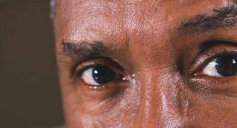 Can sinus cause black eyes