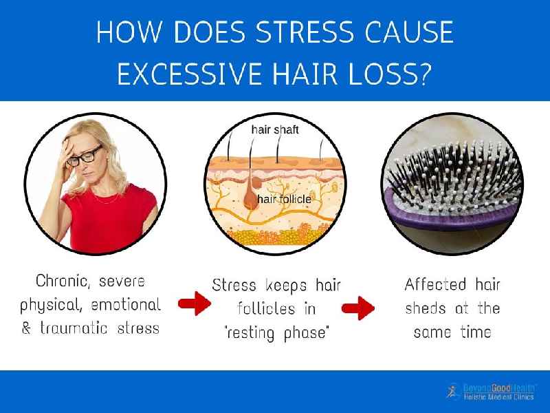 Can stress cause temple hair loss