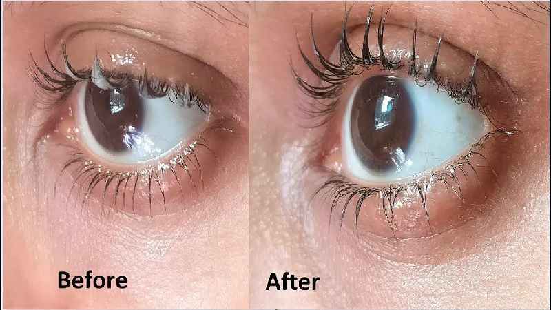 Can Vaseline grow eyelashes