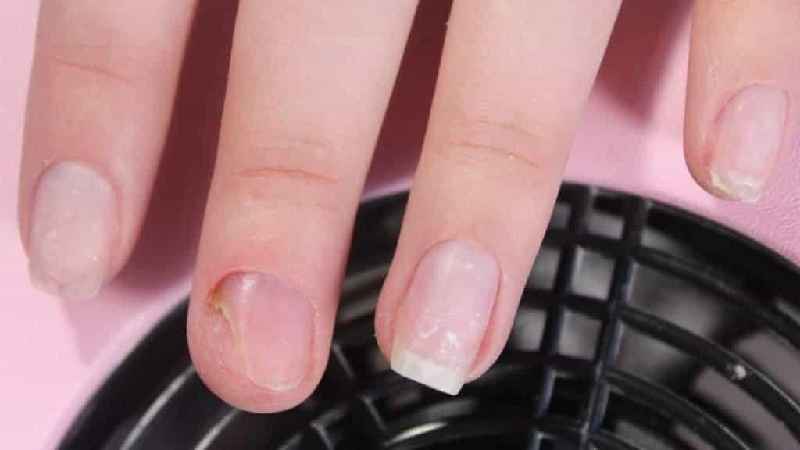 Can Vaseline help nails grow
