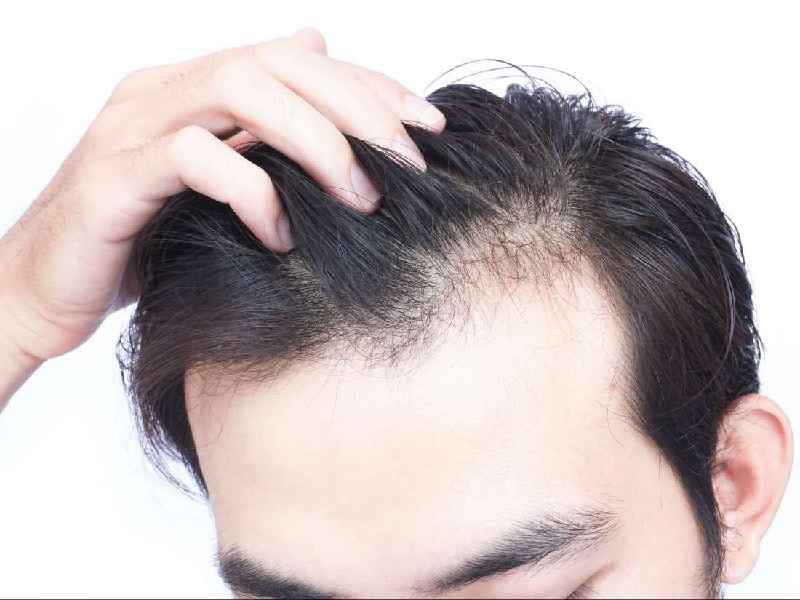 Can vitamin D deficiency cause hair thinning