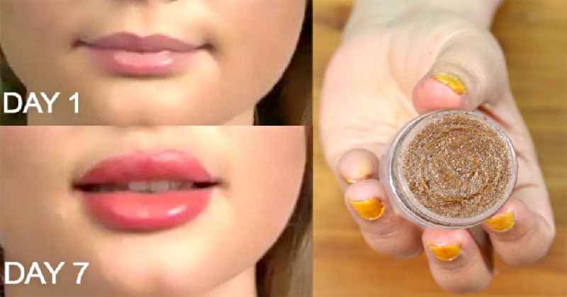 Can you epilate your upper lip