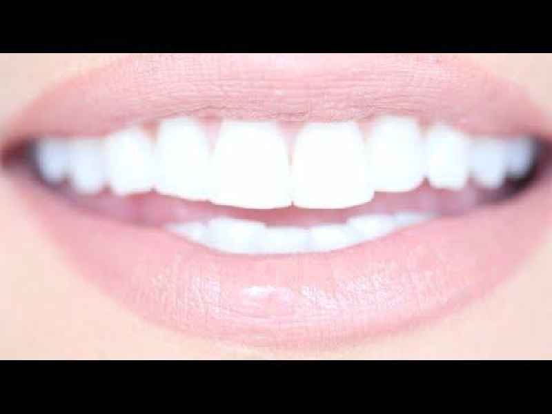 Can you get crooked teeth whitened