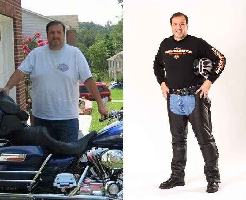 Can you get gastric sleeve at 200 lbs