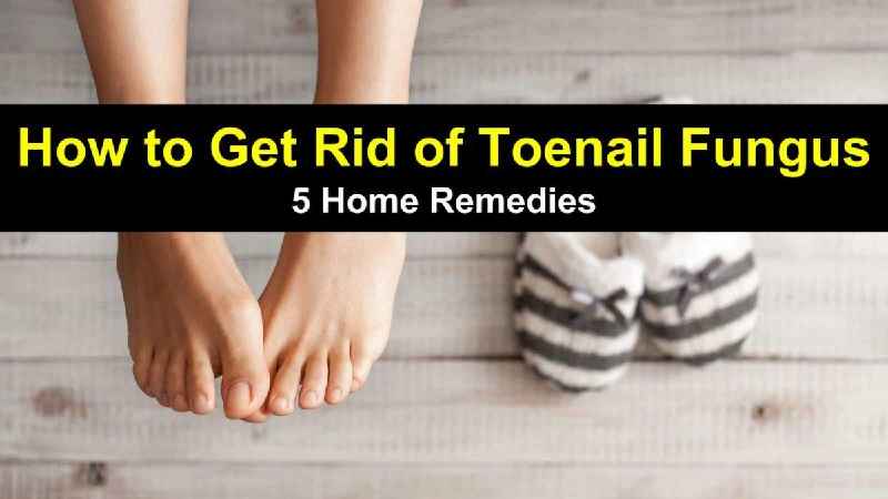 Can you get toenail fungus from shower