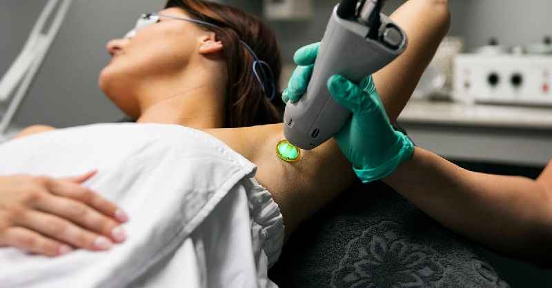 Can you pluck hairs after laser hair removal