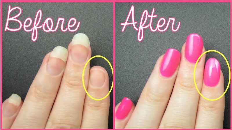 Can you put gel polish on damaged nails