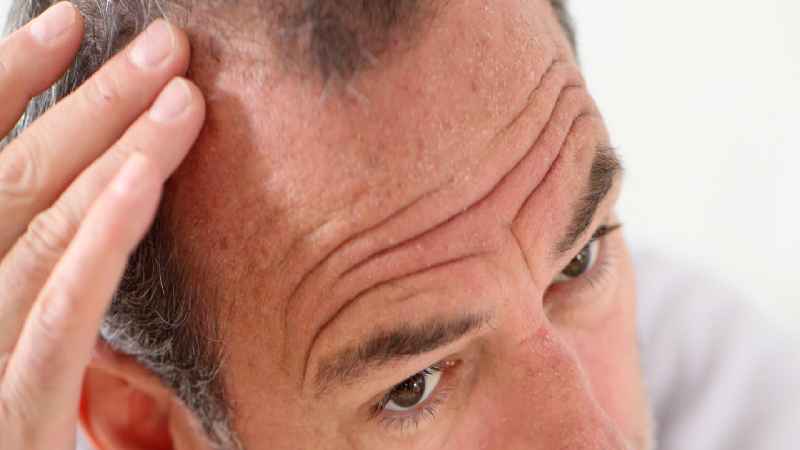 Can you reverse hair loss in females