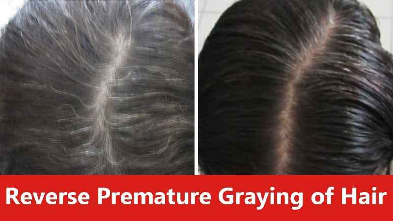 Can you reverse thinning hair