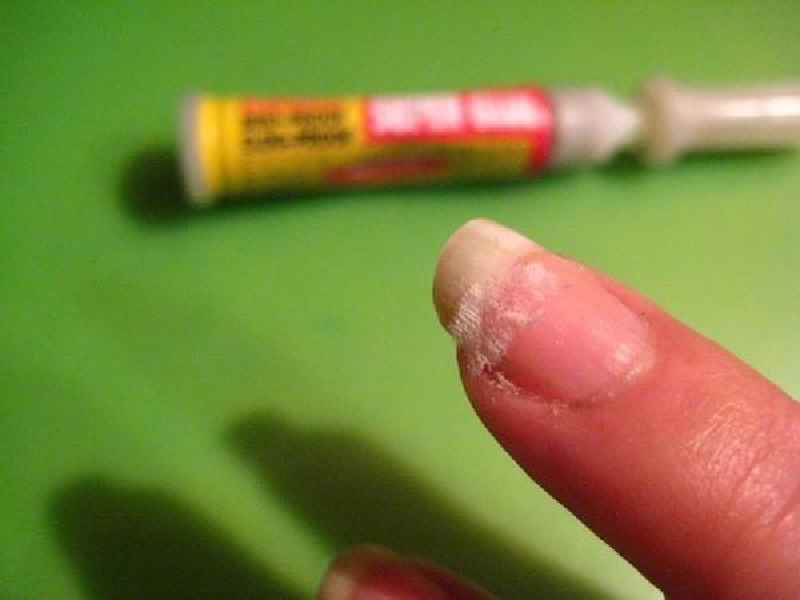 Can you super glue a broken nail