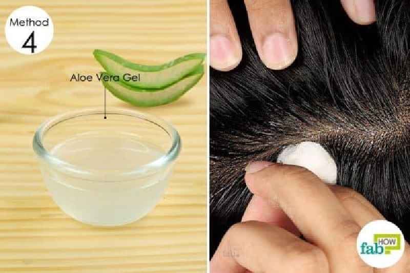 Can you use aloe vera after laser hair removal