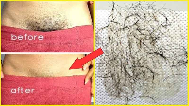 Can you use flawless hair removal on pubic area
