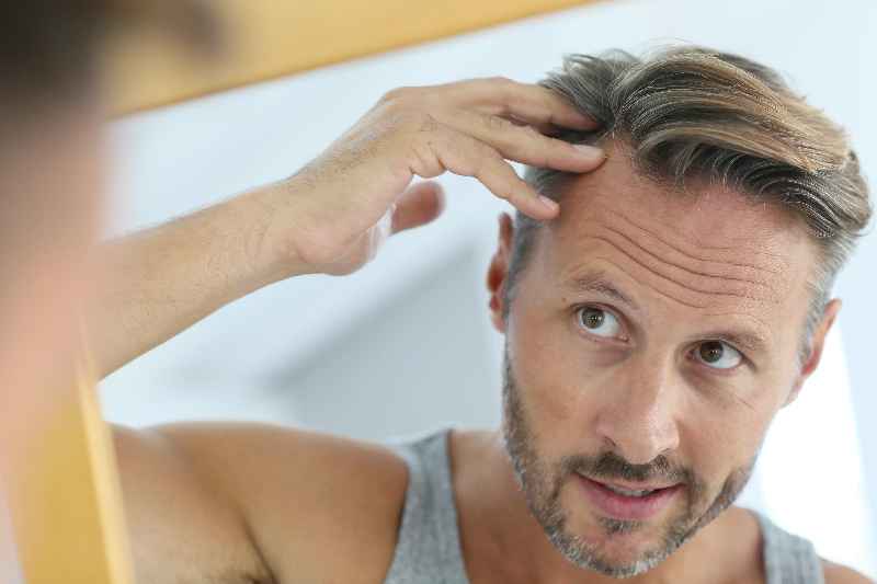 Can your hair fall out from stress