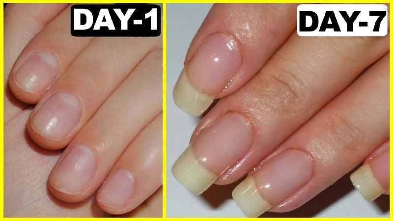 Do acrylic nails ruin your nails